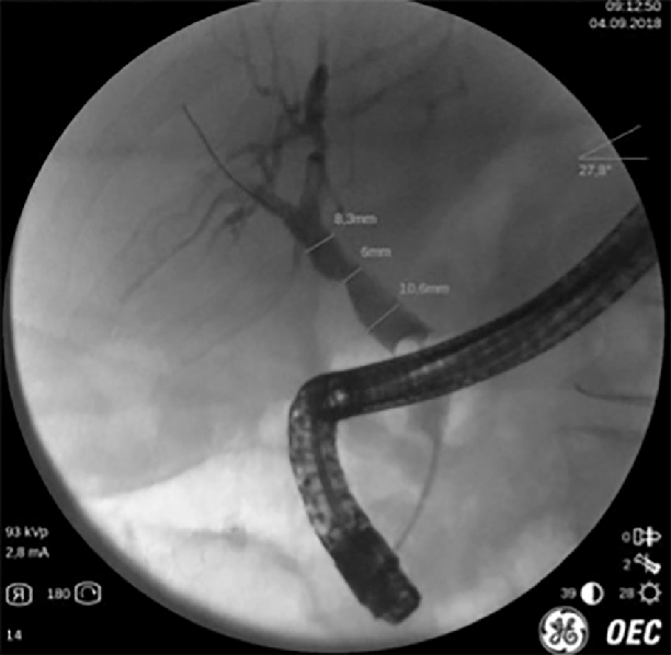 อันดับหนึ่ง 90+ ภาพ ercp ย่อมาจาก ความละเอียด 2k, 4k